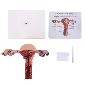 L43D Человеческая женская матка, Патологическая модель рассечения яичников, Преподавание биологии, Анатомическое поражение Матки